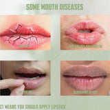 Lip Glow Cream – For Soft & Shiny Lips