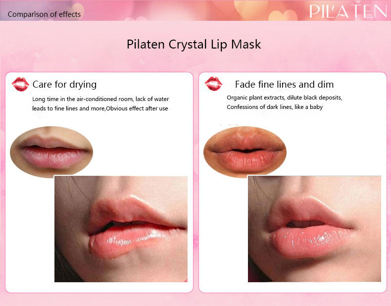 Lip Glow Cream – For Soft & Shiny Lips